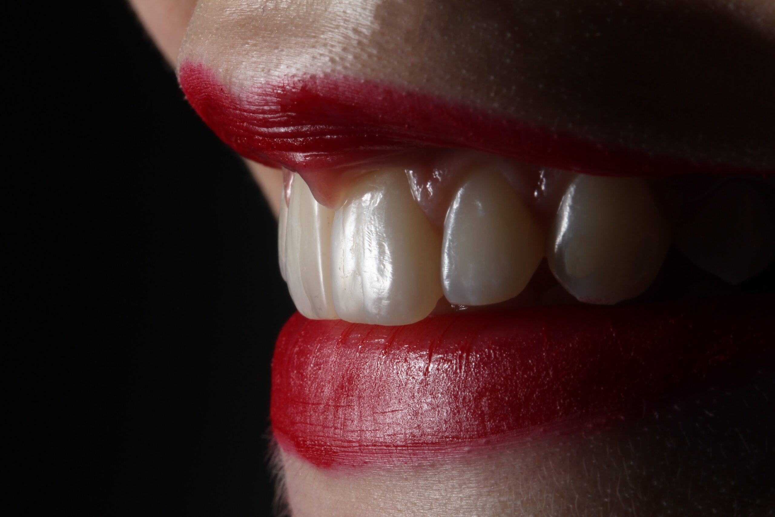 歯の黄ばみは生まれつき？原因は？おすすめの歯磨き粉と落とせない場合の対処法